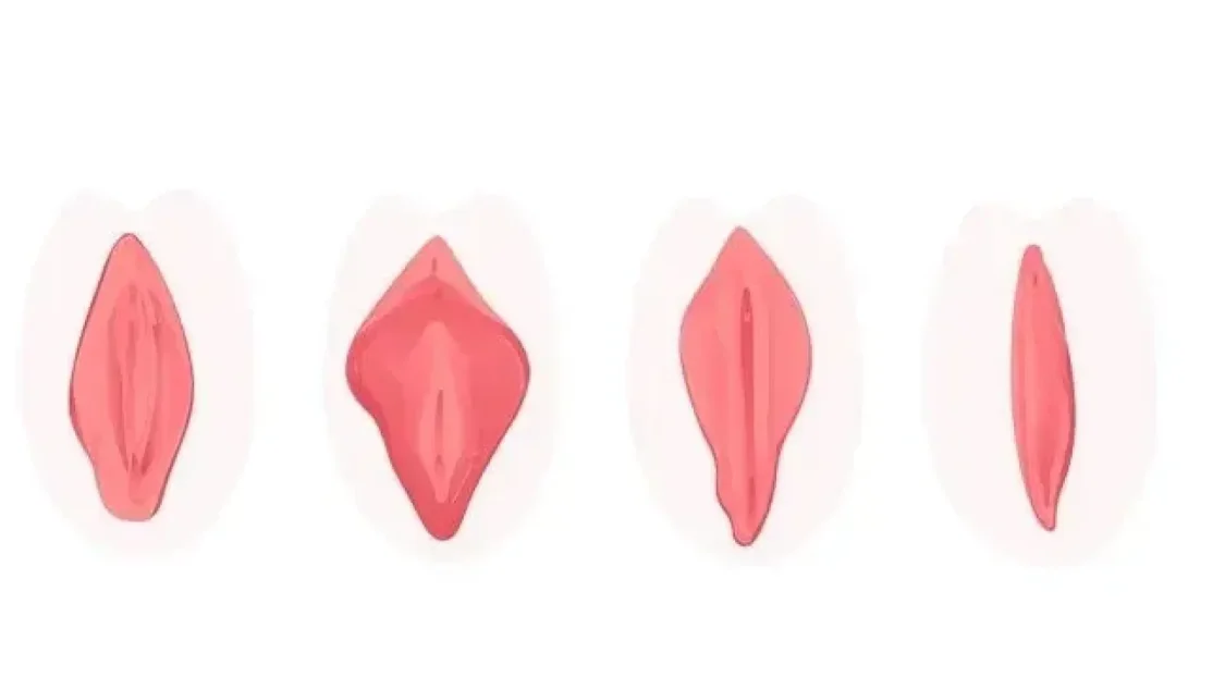 What are the different pubic hair styles for the vagina?